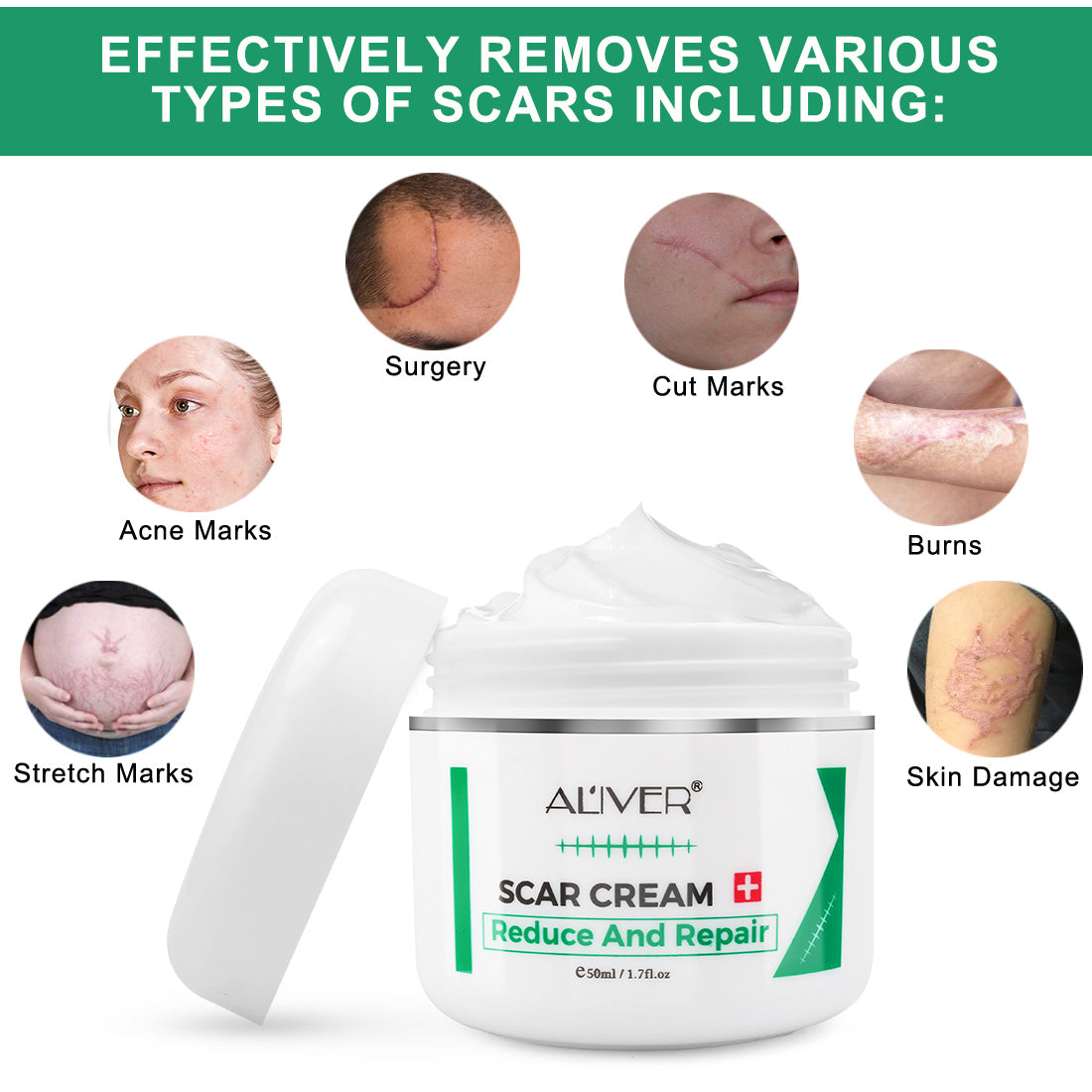 Aliver Scar Cream