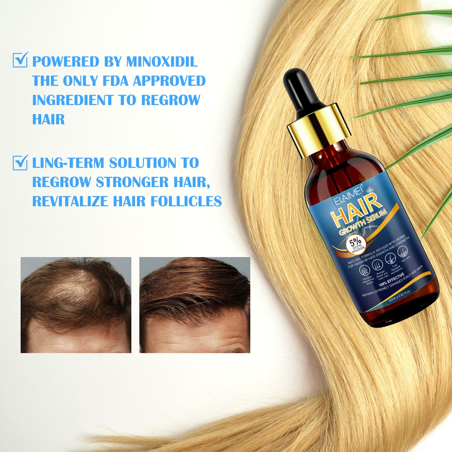 5% MINOXIDIL HAIR GROWTH SERUM FOR MEN