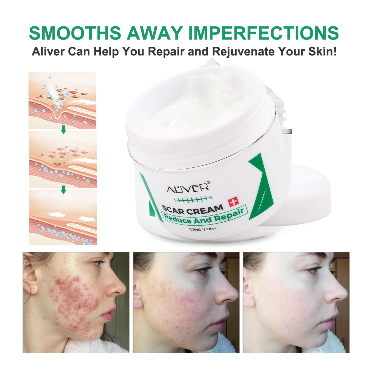 Aliver Scar Cream