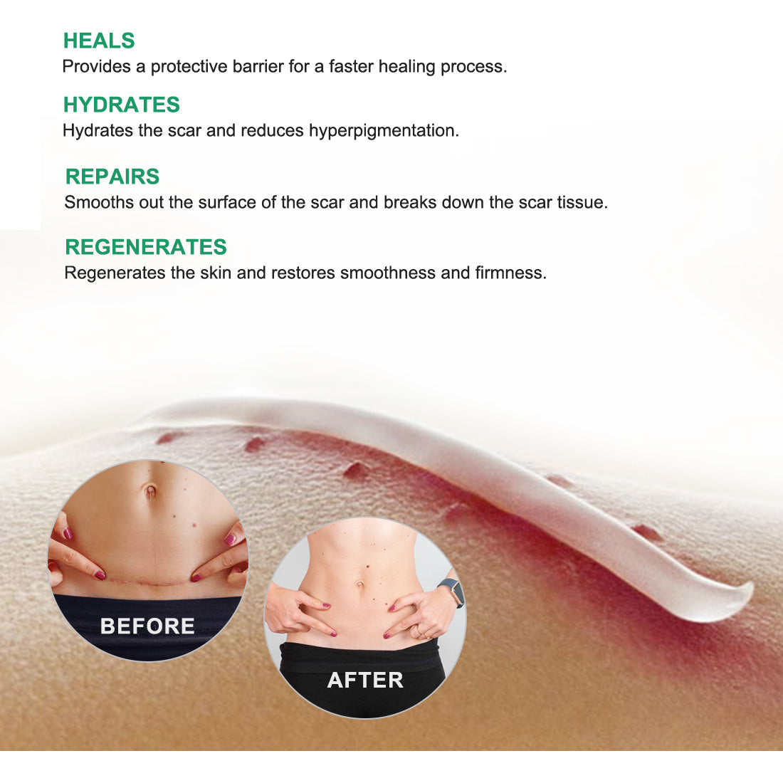 Aliver Scar Cream