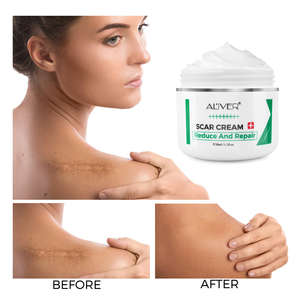 Aliver Scar Cream