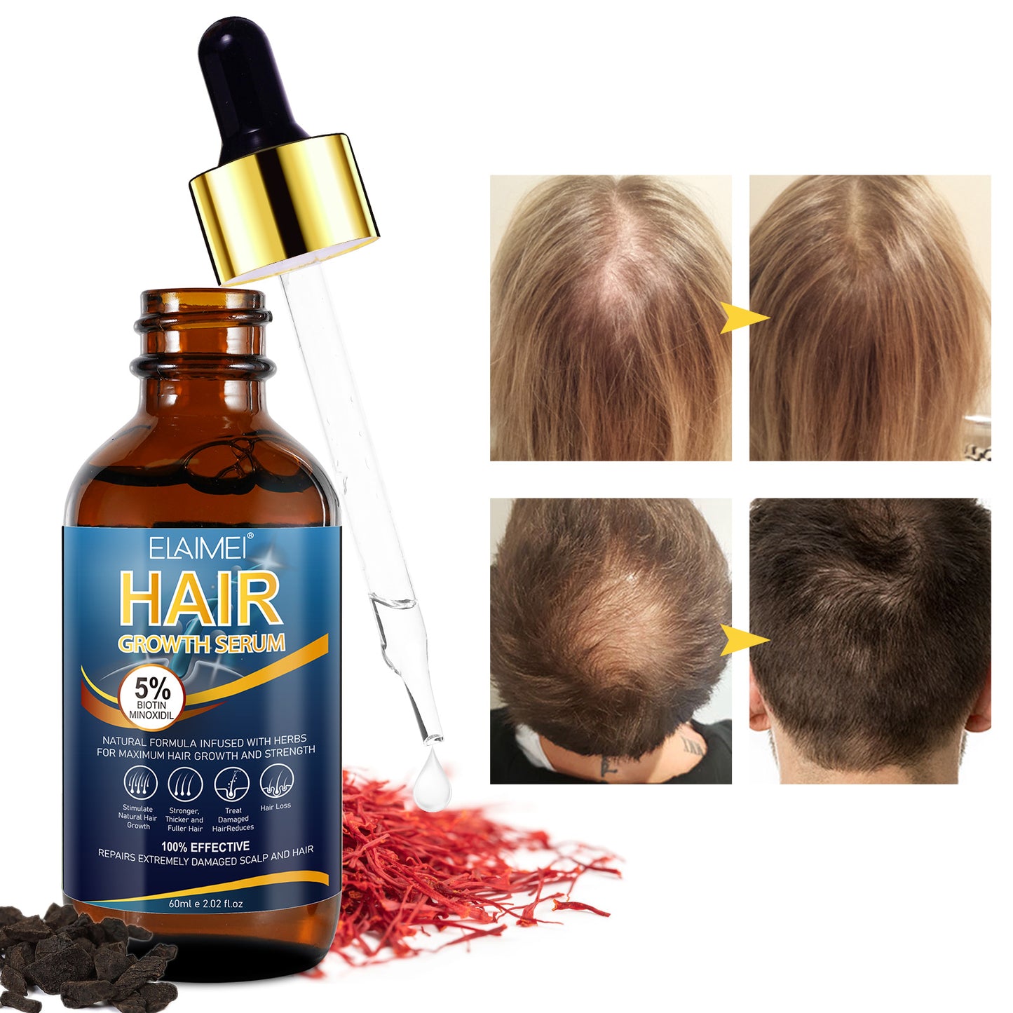 5% MINOXIDIL HAIR GROWTH SERUM FOR MEN