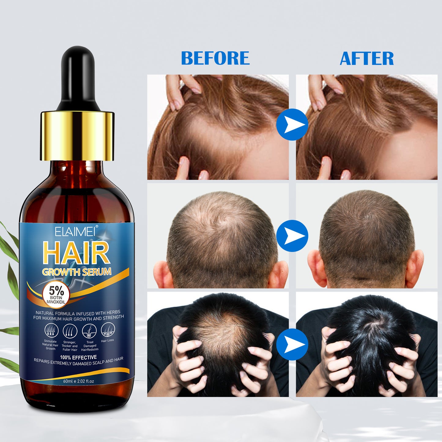 5% MINOXIDIL HAIR GROWTH SERUM FOR MEN