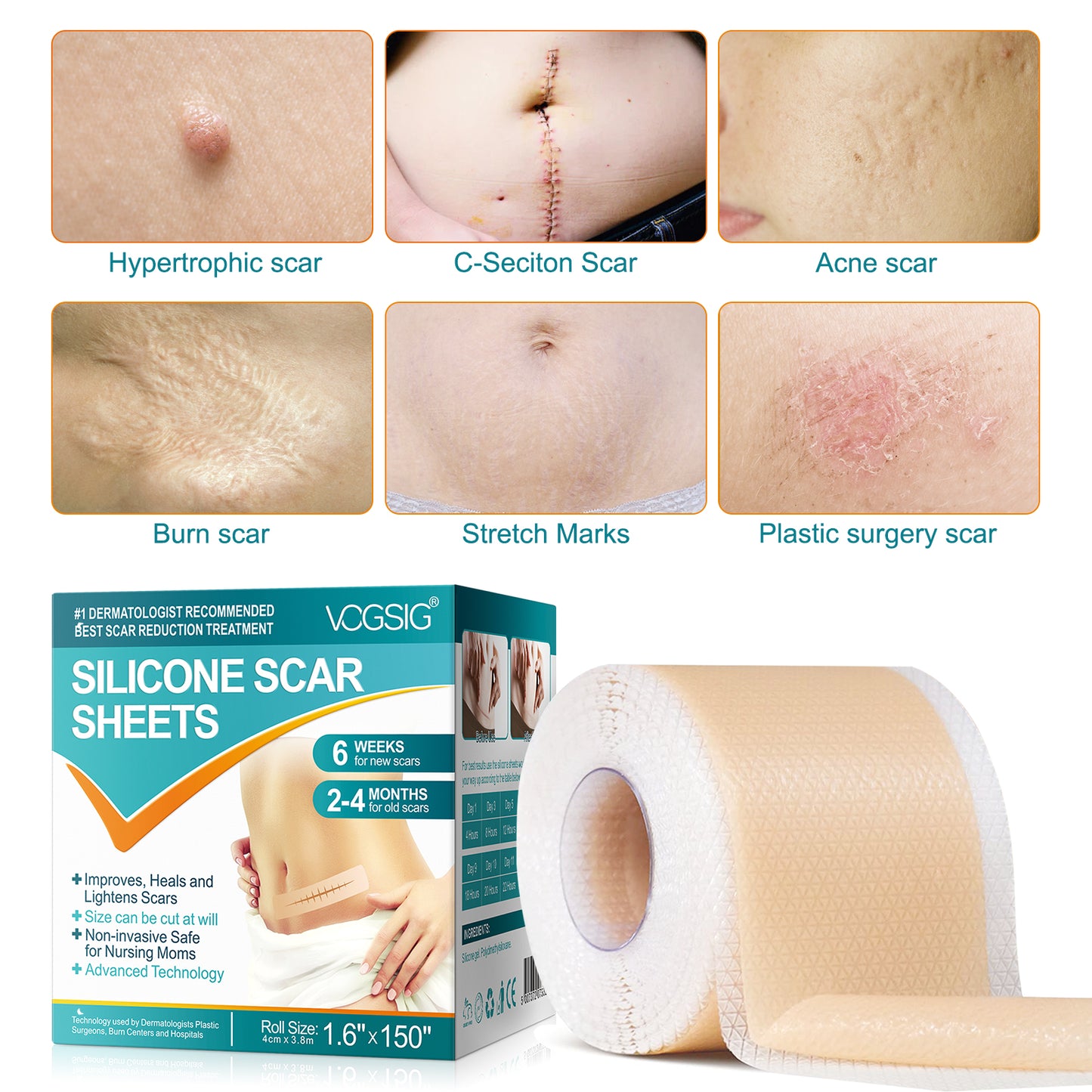 Scar Removal Tape