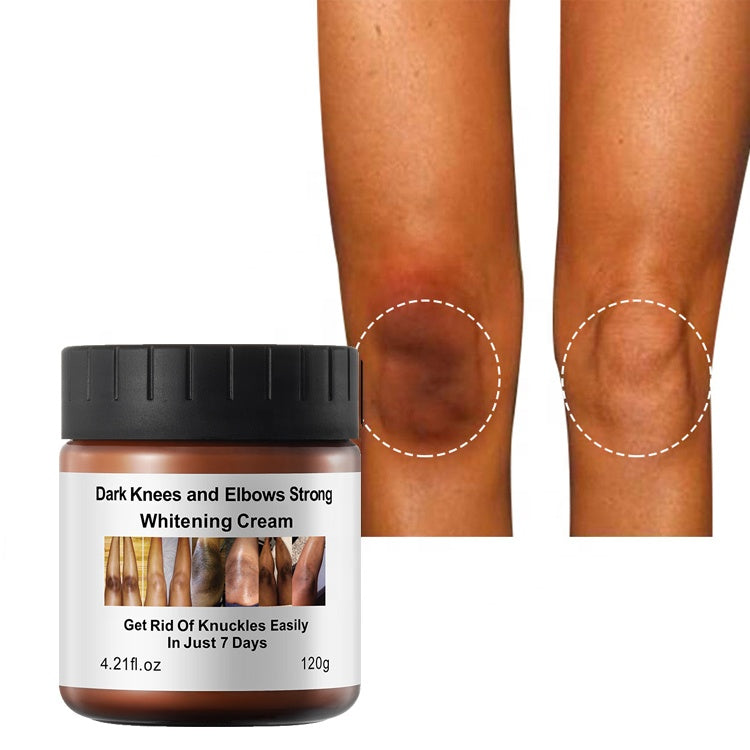 Dark Knees and Elbows Lightening Cream