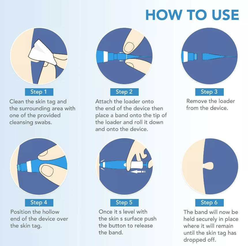 Skin Tag Remover Set