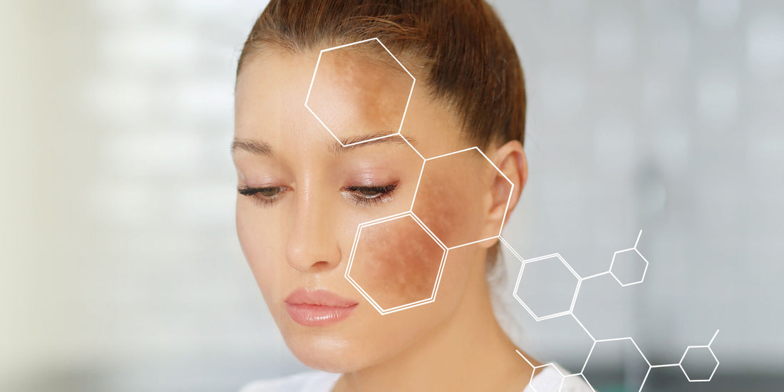 Hydroquinone - The Ultimate Dark Spot Remover: Benefits, Usage, and Results