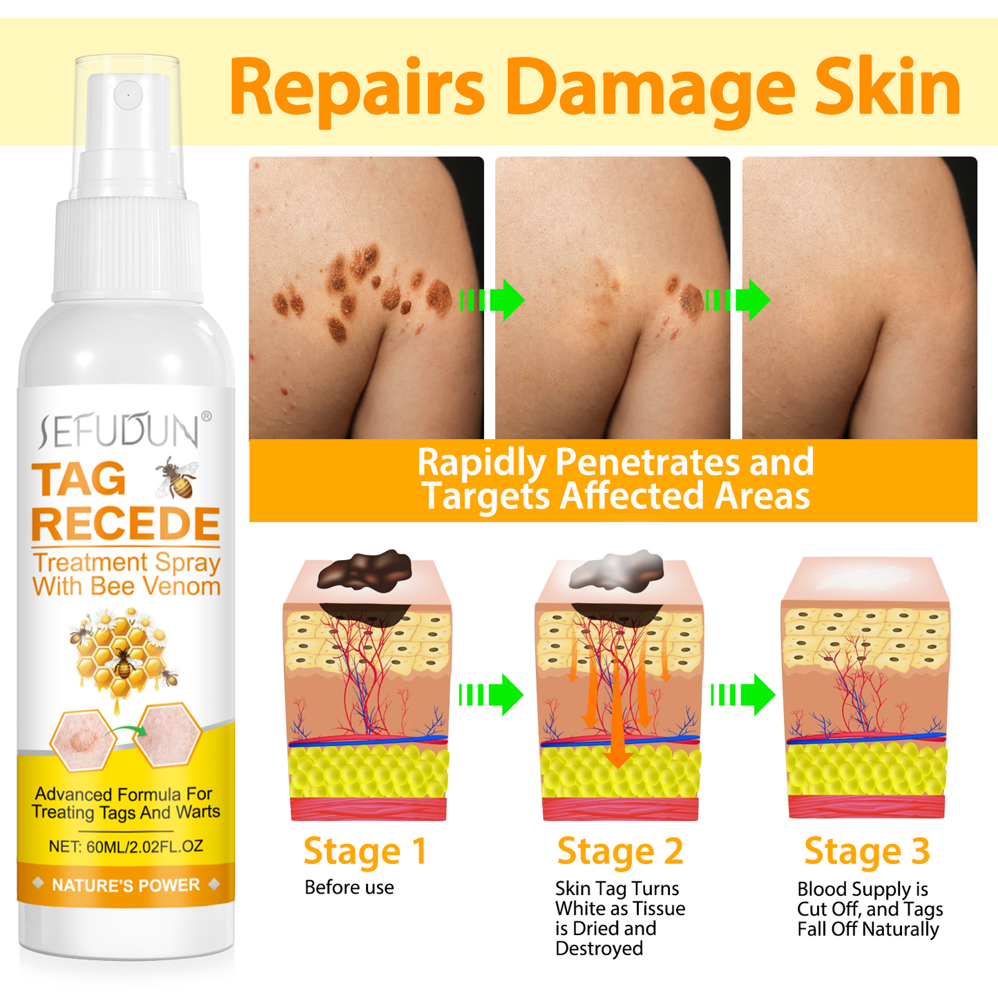 TAG RECEDE Treatment Spray with Bee Venom