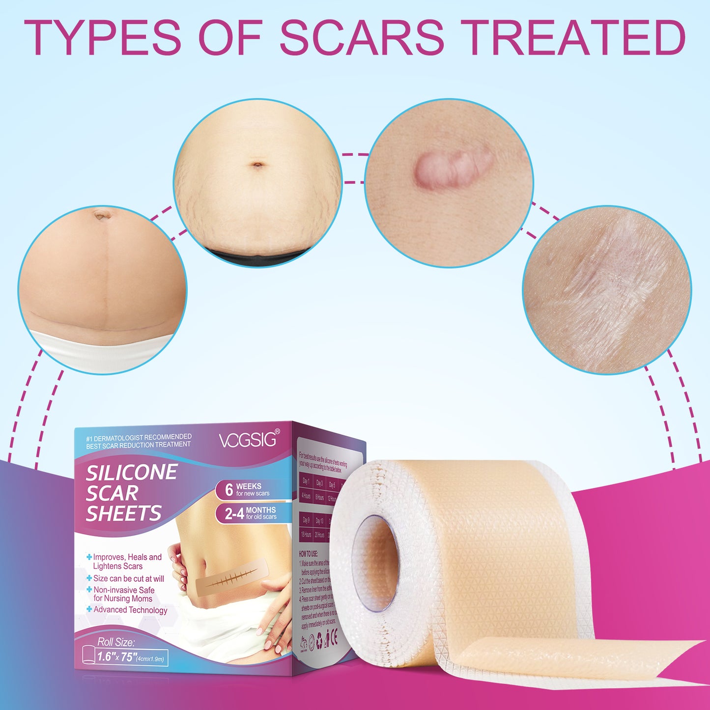 Scar Removal Tape
